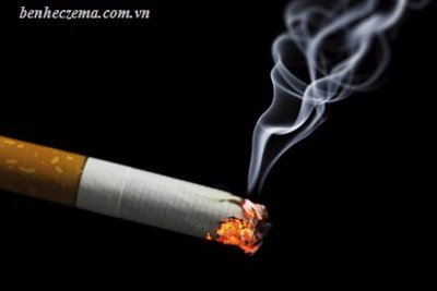 Khói thuốc lá có ảnh hưởng đến viêm da dị ứng?