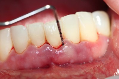 3 lời khuyên của bác sĩ Nguyễn Hồng Hải giúp giảm đau răng, viêm lợi hiệu quả