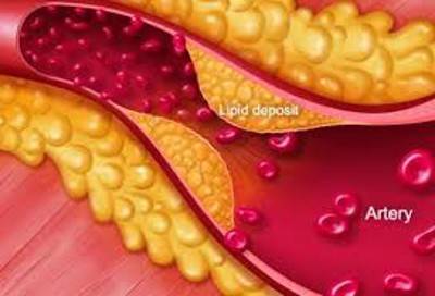 Chuyên gia Trần Quang Đạt phân tích 2 ưu điểm nổi bật của lá sen trong hỗ trợ điều trị rối loạn lipid máu