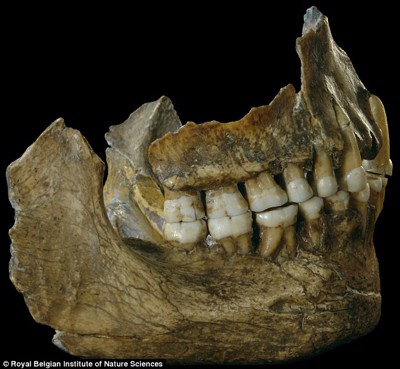 Người cổ đại dùng thuốc kháng sinh chữa đau răng từ 50.000 năm trước