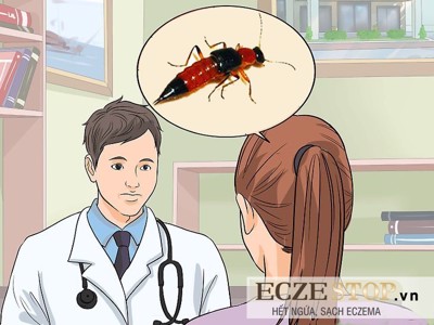 Viêm da tiếp xúc do côn trùng biểu hiện ra sao?