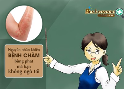 Những nguyên nhân khiến bệnh chàm BÙNG PHÁT mà bạn không ngờ tới!