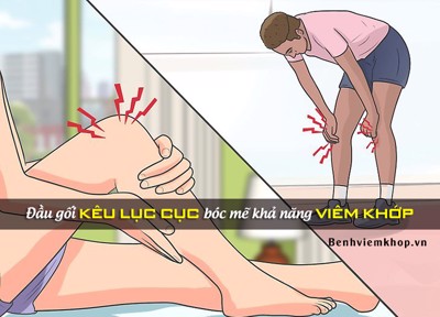 Đầu gối kêu lục cục: BÓC MẼ khả năng viêm khớp