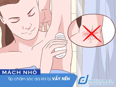 Mách nhỏ: TIP chăm sóc da dành cho người bị vẩy nến