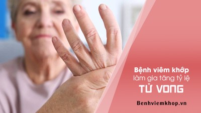 Xanh mặt khi biết có thể MẤT MẠNG vì viêm khớp dạng thấp
