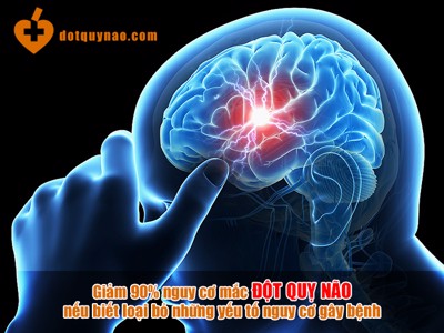 90% người đột quỵ não THOÁT CHẾT vì biết đến điều này!