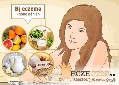 Bị eczema cần "né" ngay 4 thực phẩm này kẻo GẶP HỌA