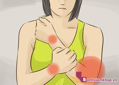 Viêm, sưng đau nhiều khớp biểu hiện của viêm đa khớp dạng thấp - Tìm hiểu ngay