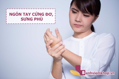 Ngón tay cứng đơ, sưng phù là biểu hiện VIÊM KHỚP bạn không thể bỏ qua