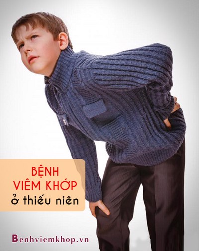 Bệnh viêm khớp ở thiếu niên - Cha mẹ cần hết sức lưu tâm