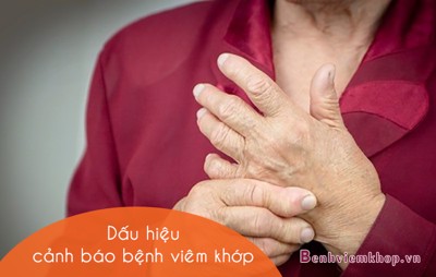 Xuất hiện hạt hay u cục ở bề mặt da có phải là dấu hiệu cảnh báo bệnh viêm khớp?