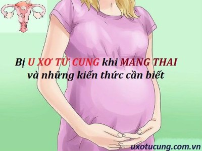 Bị u xơ tử cung khi mang thai và những điều phụ nữ cần lưu ý!