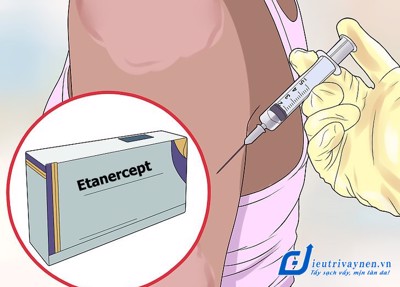 Điều trị vảy nến bằng thuốc Etanercept có ưu, nhược điểm gì?
