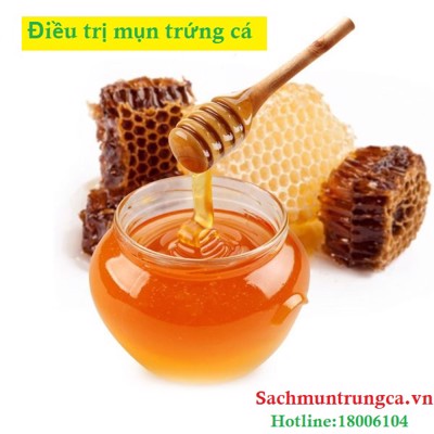 Điều trị mụn trứng cá bằng mật ong có tốt như lời đồn?