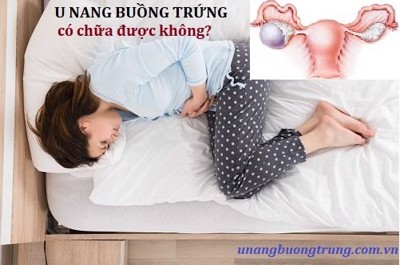 Bệnh u nang buồng trứng có chữa khỏi được không?