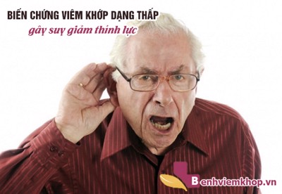 Biến chứng VIÊM KHỚP DẠNG THẤP gây nghe kém – Nguyên nhân là do đâu?