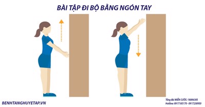 Các bài tập phục hồi chức năng sau tai biến cho cánh tay bạn có thể tập tại nhà