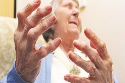 Bệnh viêm khớp dạng thấp có di truyền không? Chuyên gia Nguyễn Thị Lực giải đáp