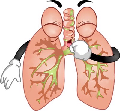 Phòng ngừa lao phổi tái phát: Bạn đã biết cách chưa?