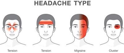 Tình trạng đau đầu được phân loại như thế nào? 