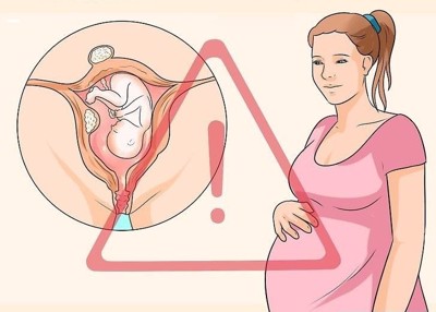 Có thai khi bị u xơ tử cung có khiến tình trạng bệnh trầm trọng hơn không?