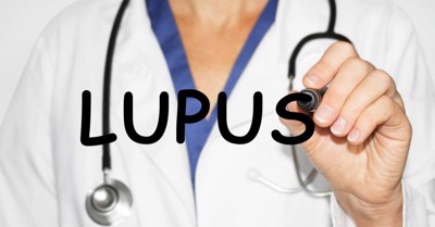 Bệnh lupus ban đỏ chữa ở đâu? Cần lưu ý gì trong thời gian điều trị không? 