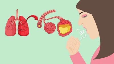 Giải đáp thắc mắc: Bị viêm phổi nên ăn hoa quả gì?