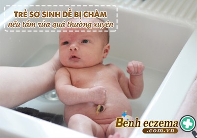 Tăng nguy cơ mắc BỆNH CHÀM ở trẻ sơ sinh nếu tắm rửa quá thường xuyên