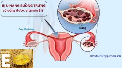 Bị bệnh u nang buồng trứng có uống vitamin E được không?