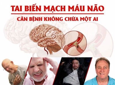 Nên dùng Nattospes như thế nào để hỗ trợ phòng ngừa tai biến tái phát?