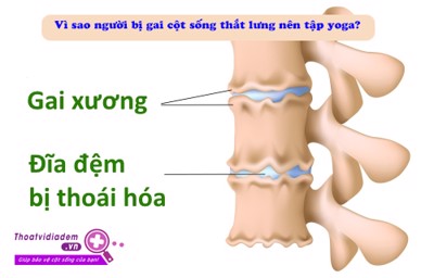 ĐIỂM DANH 10 bài tập yoga cho người bị gai cột sống thắt lưng giảm đau CỰC TỐT 