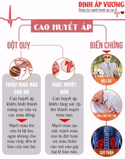 Làm sao để phòng ngừa được những biến chứng tăng huyết áp? Chuyên gia Nguyễn Đình Hiến tư vấn