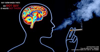 Suy giảm nhận thức nghiêm trọng sau đột quỵ do hút thuốc lá – Nên cảnh giác!
