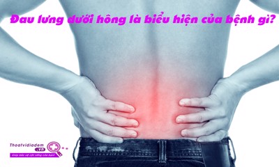 Bị đau lưng dưới hông phải làm sao? Câu trả lời chính xác dành cho bạn!