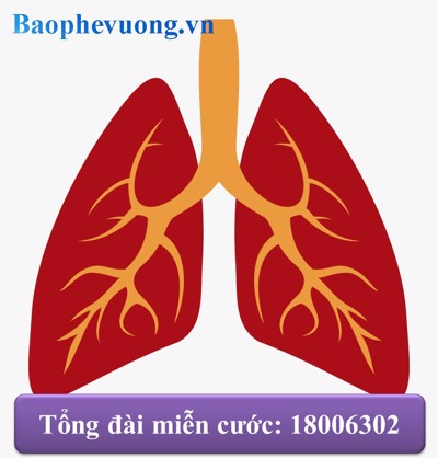 Viêm phổi thùy có lây không? Làm sao để phòng ngừa bệnh?