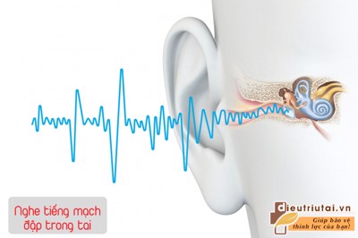 Nghe tiếng mạch đập trong tai là bị gì? Làm sao để khắc phục tại nhà?