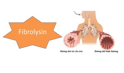Fibrolysin là gì? Tại sao Fibrolysin giúp giảm ho, long đờm hiệu quả?