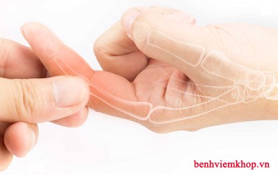Cứng khớp ngón tay không cầm nắm được - Nguyên nhân do đâu?