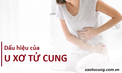 Biến chứng u xơ tử cung nguy hiểm như thế nào? Xem ngay tại đây!