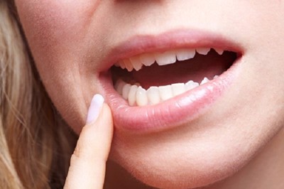 Răng hàm bị lung lay có cải thiện được không? Chuyên gia Văn Trọng Lân tư vấn