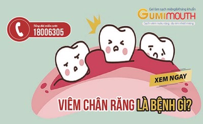 Viêm chân răng là gì? Dùng Gumimouth có cải thiện được không? XEM NGAY!