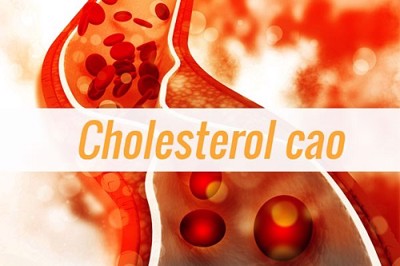 Chỉ số cholesterol là 5,7mmol/L và triglycerid là 1,42 mmol/L thì đã bị mỡ máu cao chưa?