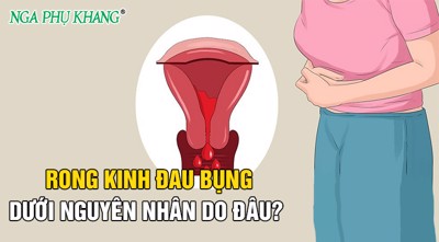 Rong kinh đau bụng dưới nguyên nhân do đâu? - Xem ngay