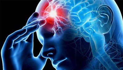 Người bị đau đầu 30 năm không rõ nguyên nhân điều trị như thế nào?