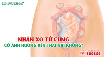 Bệnh nhân xơ tử cung có ảnh hưởng đến thai nhi không?