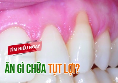 Giải đáp thắc mắc: Ăn gì chữa tụt lợi? TÌM HIỂU NGAY!