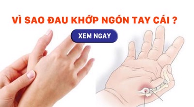 Giải đáp thắc mắc: “Vì sao đau khớp ngón tay cái?”. Dấu hiệu nhận biết và cách cải thiện từ thảo dược