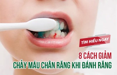 8 cách giảm chảy máu chân răng khi đánh răng 