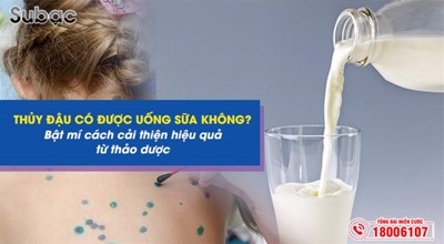 Thủy đậu có được uống sữa không? Bật mí cách cải thiện hiệu quả từ thảo dược