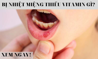 Bị nhiệt miệng thiếu vitamin gì? TÌM HIỂU NGAY!